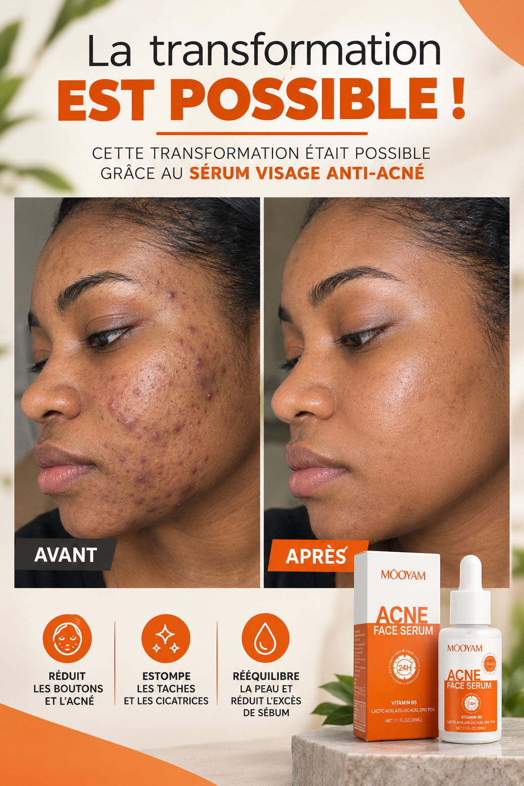 Sérum Anti Acné