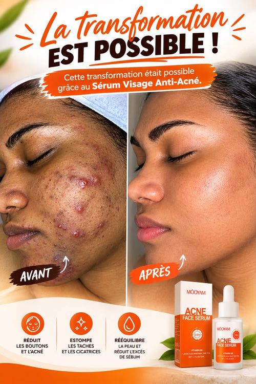Sérum anti acnée